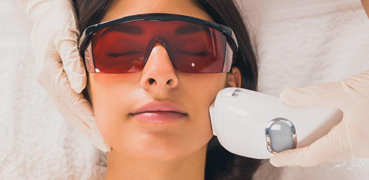 LASER SKIN TIGHTENING